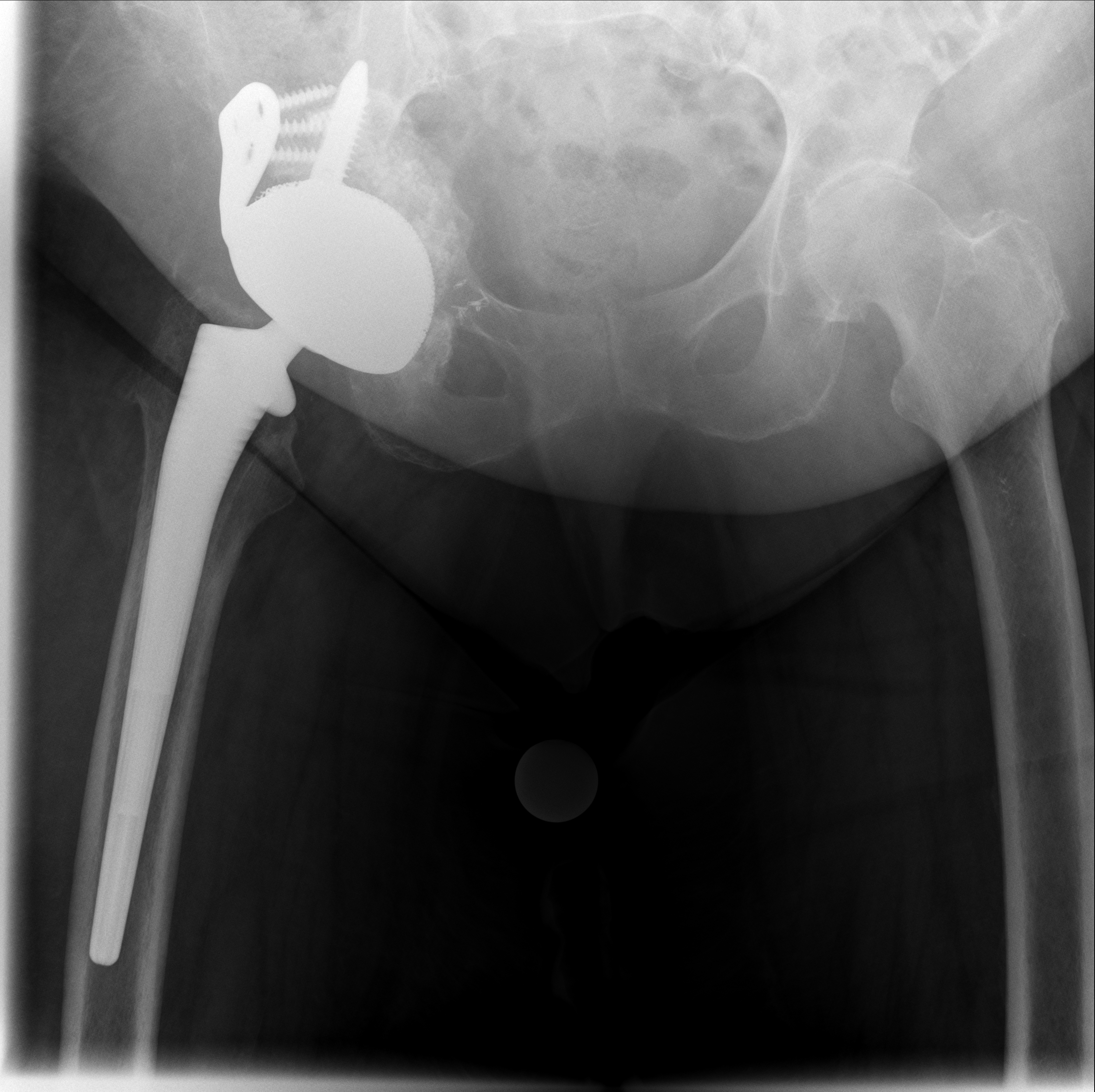 Röntgen Februar 2026